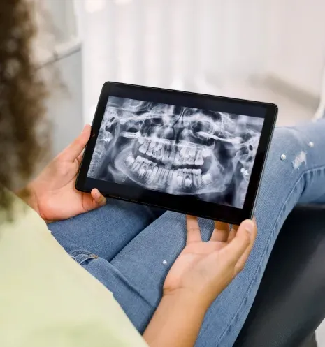 Person holding a tablet displaying a dental panoramic X-ray image