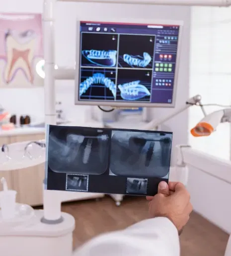 Digital Workflow for Advanced Full Mouth Implant Treatments