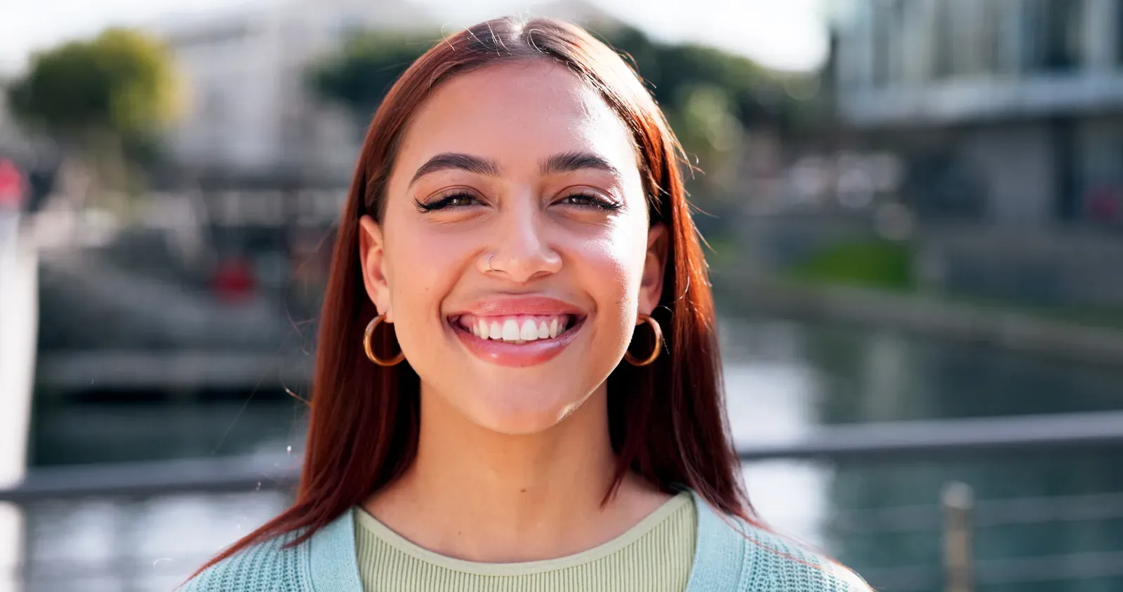 Smile gallery photo